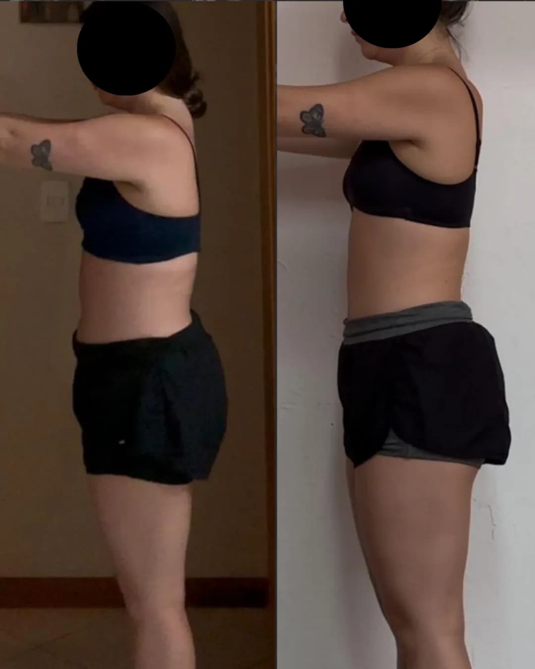 Antes e depois – resultado 1
